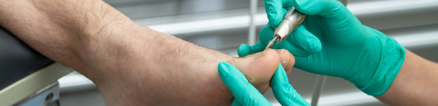 Medisch pedicure
